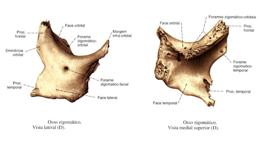 Osso Zigom Tico Anatomia Papel E Caneta