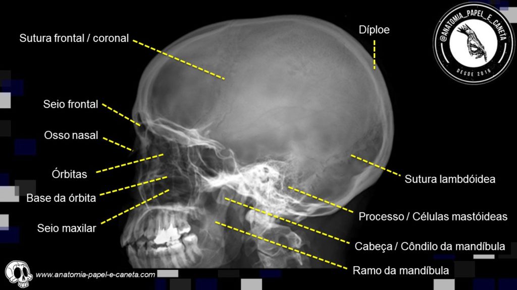 anatomia radiológica do crânio Anatomia papel e caneta