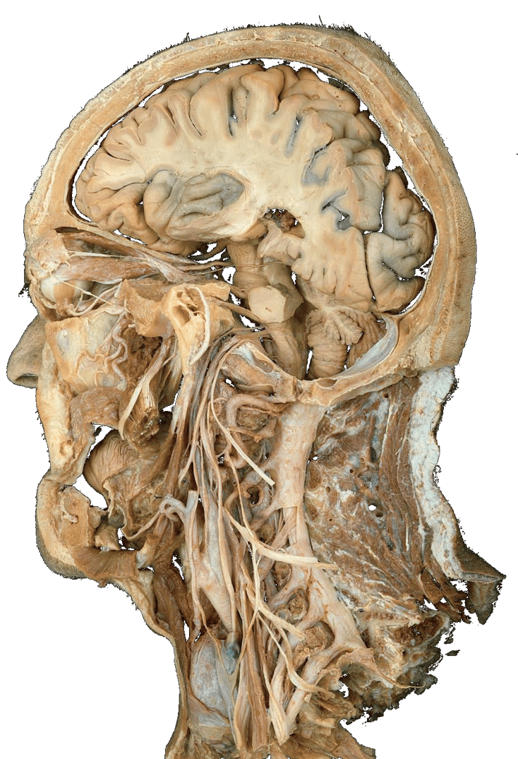 Cadaver Anatomia Papel E Caneta