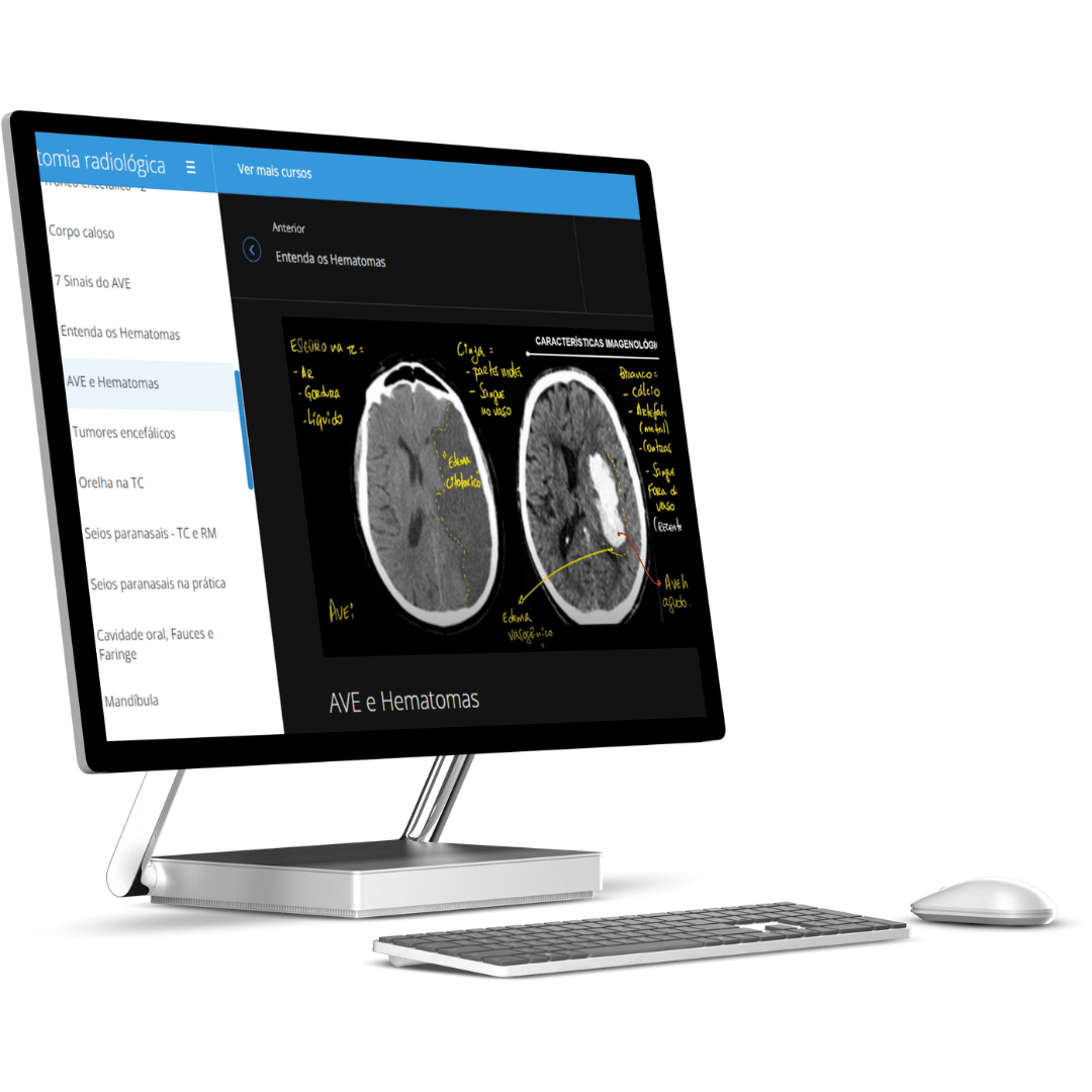 Curso De Neuroanatomia Anatomia Papel E Caneta