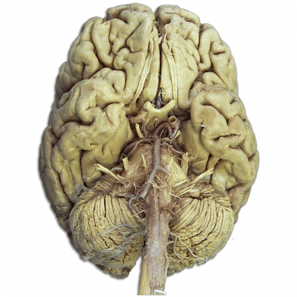 nervos cranianos em cadaver